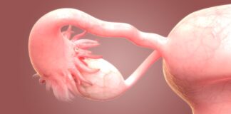 JSKN003 Earns FDA Breakthrough Therapy Designation for HER2-Expressing PROC Patients currently enrolled on the RAMP 203 trial will have the option of continuing treatment with the avutometinib regimen per investigator discretion.