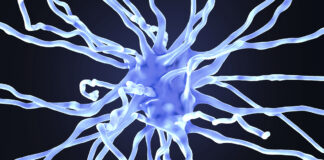 New Drug Stalls Alzheimer’s Development in Breakthrough Trial : ScienceAlert New Drug Stalls Alzheimer's Development in Breakthrough Trial : ScienceAlert