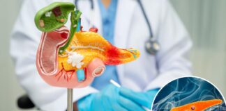 Pancreatic cancer breakthrough: tumors disappear in mice Pancreatic cancer breakthrough: tumors disappear in mice