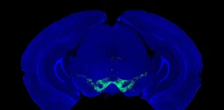 Parkinson’s breakthrough changes what we know about dopamine Parkinson’s breakthrough changes what we know about dopamine