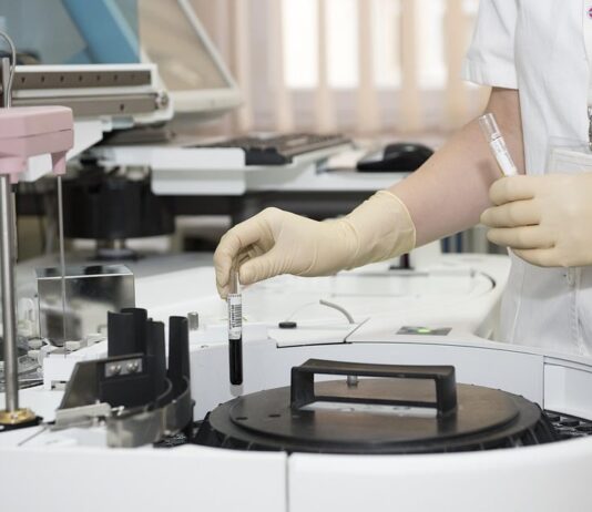 UPF Heart Model Aids Arrhythmia Treatment Advances UPF Heart Model Aids Arrhythmia Treatment Advances