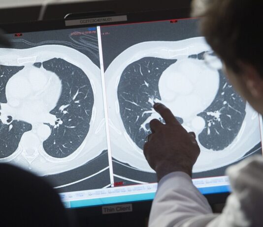 US Cancer Survivor Ranks Grow as Detection Rises and Deaths Drop US Cancer Survivor Ranks Grow as Detection Rises and Deaths Drop