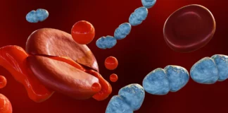 Breakthrough sepsis drug shows promise in human trial Breakthrough sepsis drug shows promise in human trial