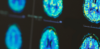 Bridging the Gap: How the University of Utah’s StrokeNet Is Delivering Breakthroughs to the Mountain West | University of Utah Health Bridging the Gap: How the University of Utah's StrokeNet Is Delivering Breakthroughs to the Mountain West | University of Utah Health