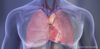 Experts encourage healthy heart habits for American Heart Month Experts encourage healthy heart habits for American Heart Month