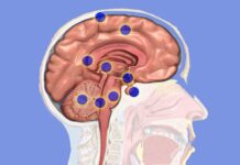 Laser Therapy Breakthrough May Extend Survival in Aggressive Brain Cancer ‹ ColoradoBoulevard.net ColoradoBoulevard.net
