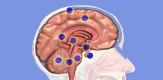 Laser Therapy Breakthrough May Extend Survival in Aggressive Brain Cancer ‹ ColoradoBoulevard.net ColoradoBoulevard.net
