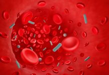 Sepsis ‘breakthrough’: the world’s first targeted treatment? Sepsis ‘breakthrough’: the world’s first targeted treatment?