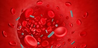 Sepsis ‘breakthrough’: the world’s first targeted treatment? Sepsis ‘breakthrough’: the world’s first targeted treatment?