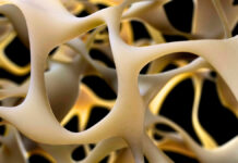 Breakthrough to Strengthen Bones Could Reverse Osteoporosis : ScienceAlert Breakthrough to Strengthen Bones Could Reverse Osteoporosis : ScienceAlert