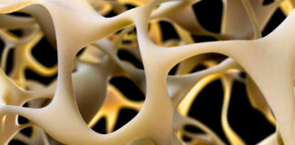 Breakthrough to Strengthen Bones Could Reverse Osteoporosis : ScienceAlert Breakthrough to Strengthen Bones Could Reverse Osteoporosis : ScienceAlert