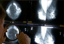 Breast cancer breakthroughs: New pill combo, shorter therapy show promise Breast cancer breakthroughs: New pill combo, shorter therapy show promise