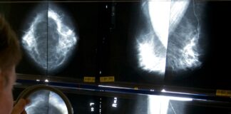 Breast cancer breakthroughs: New pill combo, shorter therapy show promise Breast cancer breakthroughs: New pill combo, shorter therapy show promise