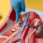 Doctors link diet and sedentary lifestyle to surge, share ways to prevent kidney stones and gout Doctors link diet and sedentary lifestyle to surge, share ways to prevent kidney stones and gout