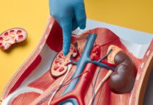 Doctors link diet and sedentary lifestyle to surge, share ways to prevent kidney stones and gout Doctors link diet and sedentary lifestyle to surge, share ways to prevent kidney stones and gout