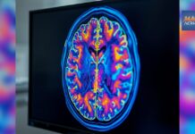 Maui Health hosts free community seminar on brain health and healthy aging, March 18 : Maui Now Maui Health hosts free community seminar on brain health and healthy aging, March 18 : Maui Now