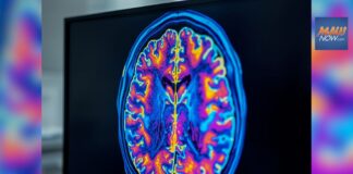 Maui Health hosts free community seminar on brain health and healthy aging, March 18 : Maui Now Maui Health hosts free community seminar on brain health and healthy aging, March 18 : Maui Now
