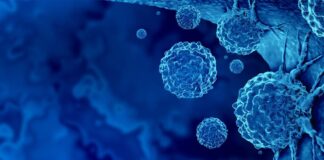 Tiny bubbles, big breakthrough: cracking cancer’s “fortress” | CWRU Newsroom Tiny bubbles, big breakthrough: cracking cancer’s “fortress” | CWRU Newsroom