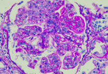 Autoimmune field buoyed by successes with CAR-T treatments Autoimmune field buoyed by successes with CAR-T treatments