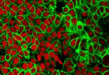 Colorectal cancer breakthroughs: Early detection through AI, drug-chemotherapy combination Colorectal cancer breakthroughs: Early detection through AI, drug-chemotherapy combination