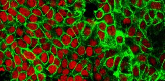 Colorectal cancer breakthroughs: Early detection through AI, drug-chemotherapy combination Colorectal cancer breakthroughs: Early detection through AI, drug-chemotherapy combination
