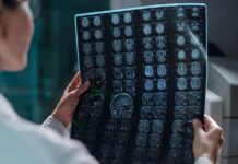 Demystifying dementia – WHYY Demystifying dementia - WHYY