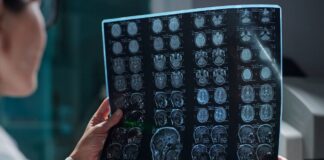 Demystifying dementia – WHYY Demystifying dementia - WHYY