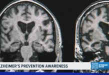 New report highlights habits that may help protect brain health New report highlights habits that may help protect brain health