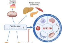 Quality versus quantity of fat in the diet affects development of diabetes Quality versus quantity of fat in the diet affects development of diabetes