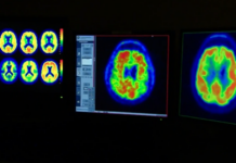 Ten healthy habits that can help support brain health Ten healthy habits that can help support brain health