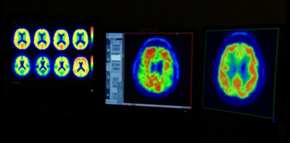 Ten healthy habits that can help support brain health Ten healthy habits that can help support brain health