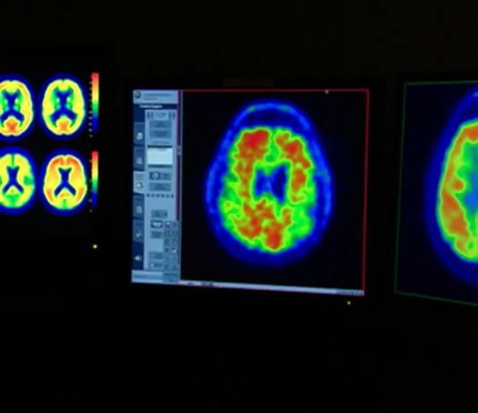 Ten healthy habits that can help support brain health Ten healthy habits that can help support brain health