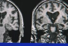 Ten healthy habits to help your brain | Health Minute Ten healthy habits to help your brain | Health Minute