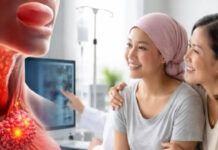 Tongue Cancer Recovery: Immunotherapy Breakthrough Explained Tongue Cancer Recovery: Immunotherapy Breakthrough Explained