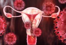 Cervical Cancer Prevention Tips: Cervical Cancer claims over 3.5 lakh lives every year: Doctor shares common healthy habits that can reduce the risk | Cervical Cancer Prevention Tips: Cervical Cancer claims over 3.5 lakh lives every year: Doctor shares common healthy habits that can reduce the risk |