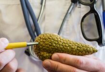 Inside Biotech: OncoSil’s TGA breakthrough puts focus back on pancreatic cancer challenge Inside Biotech: OncoSil’s TGA breakthrough puts focus back on pancreatic cancer challenge