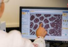 UH Researchers Find Potential Breakthrough for Crohn’s Disease Treatment UH Researchers Find Potential Breakthrough for Crohn’s Disease Treatment